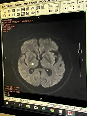 MRT診断画像